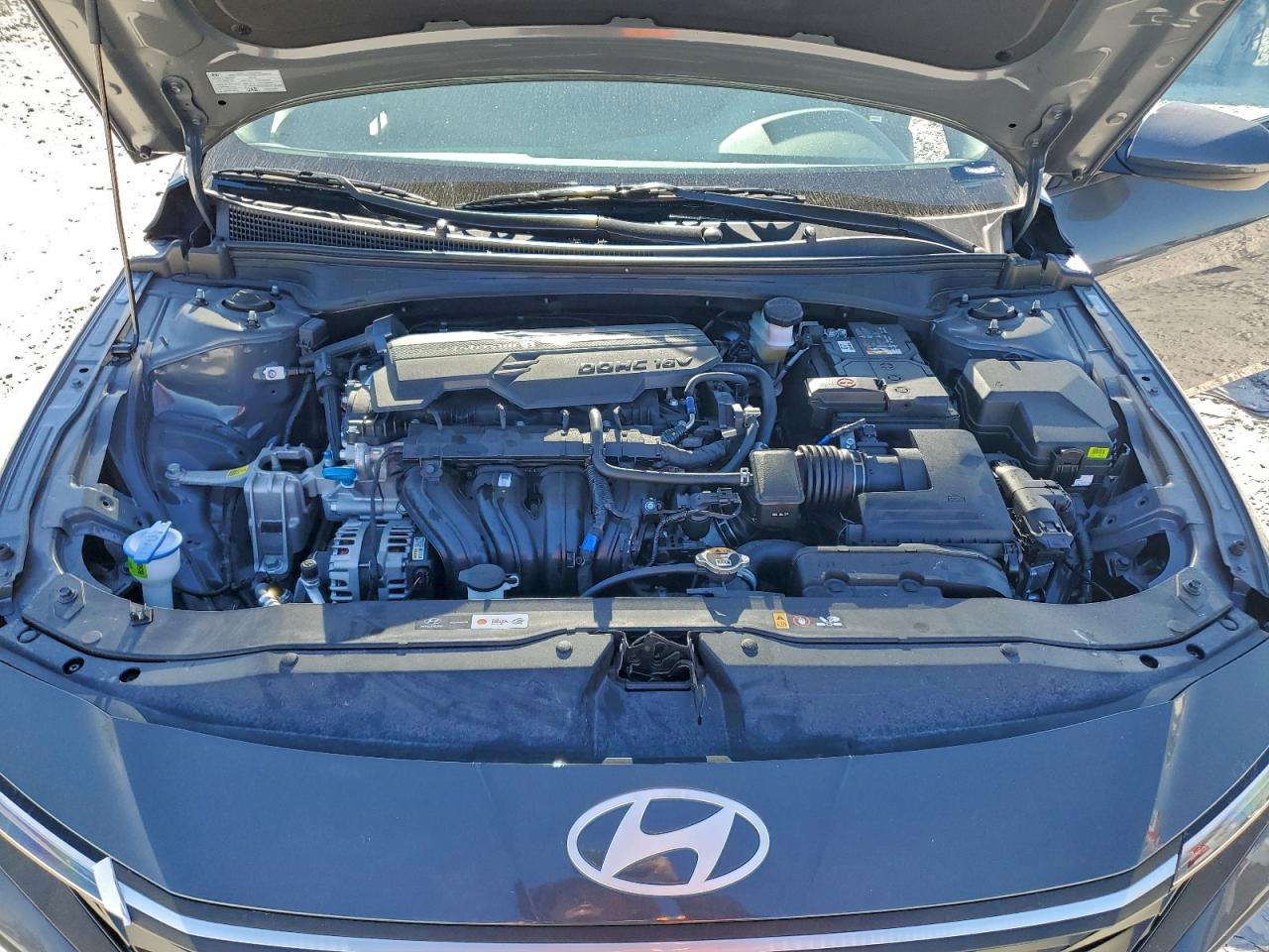 Hyundai ELANTRA Se Image 4