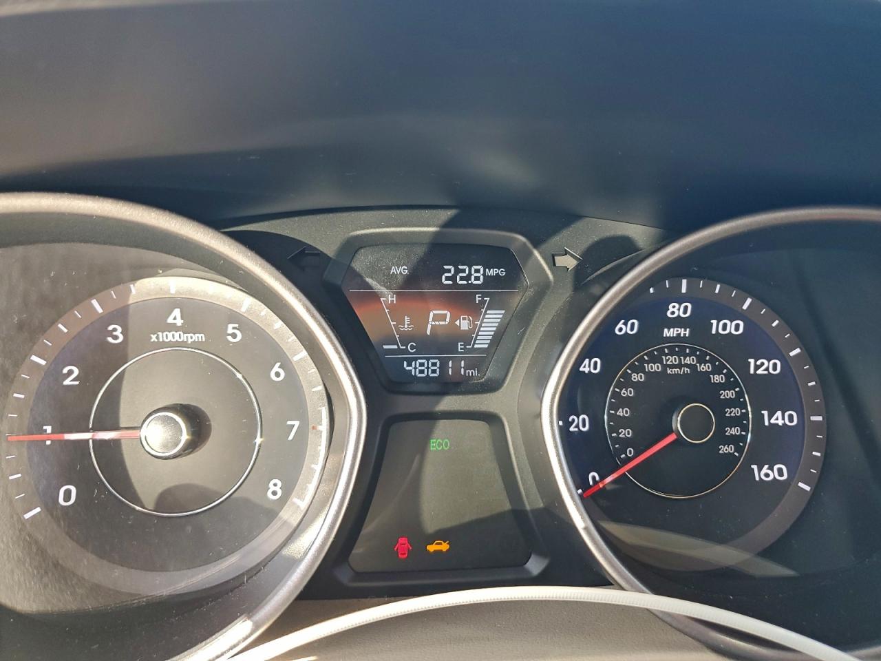 Hyundai ELANTRA Se Image 6